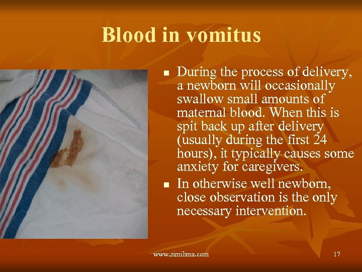 Blood in vomitus n n During the process of delivery, a newborn will occasionally