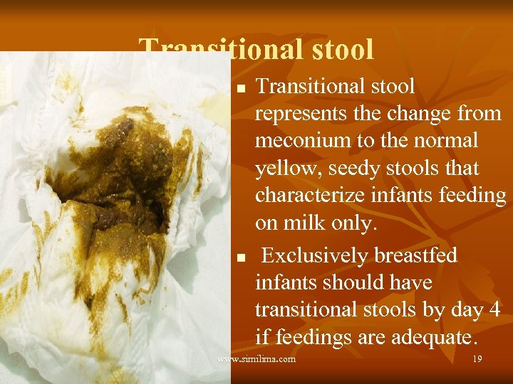 Transitional stool n n Transitional stool represents the change from meconium to the normal