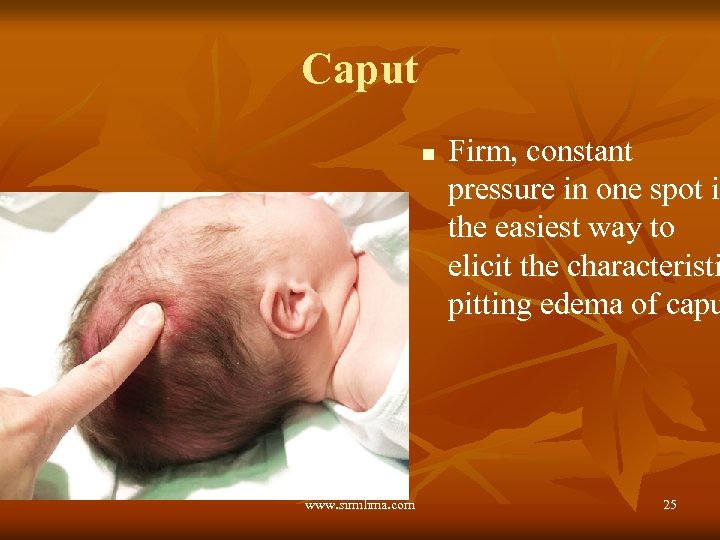 Caput n www. similima. com Firm, constant pressure in one spot is i the