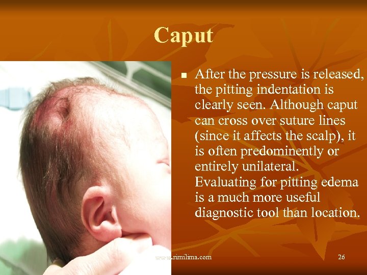 Caput n After the pressure is released, the pitting indentation is clearly seen. Although
