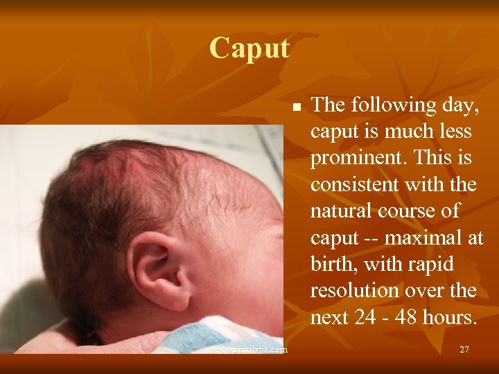 Caput n www. similima. com The following day, caput is much less prominent. This