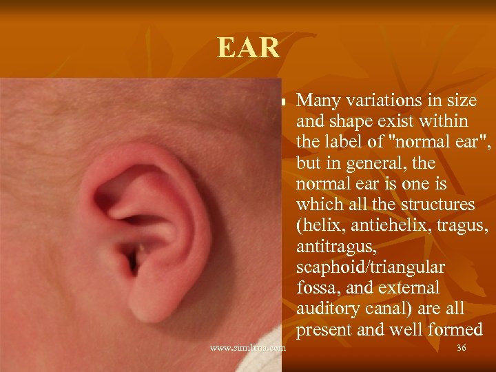 EAR n www. similima. com Many variations in size and shape exist within the