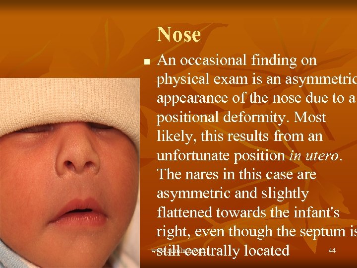 Nose n An occasional finding on physical exam is an asymmetric appearance of the