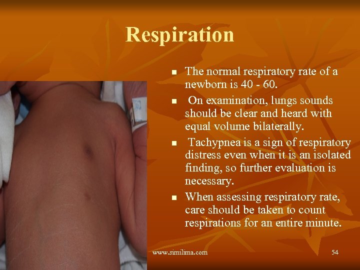 Respiration n n The normal respiratory rate of a newborn is 40 - 60.