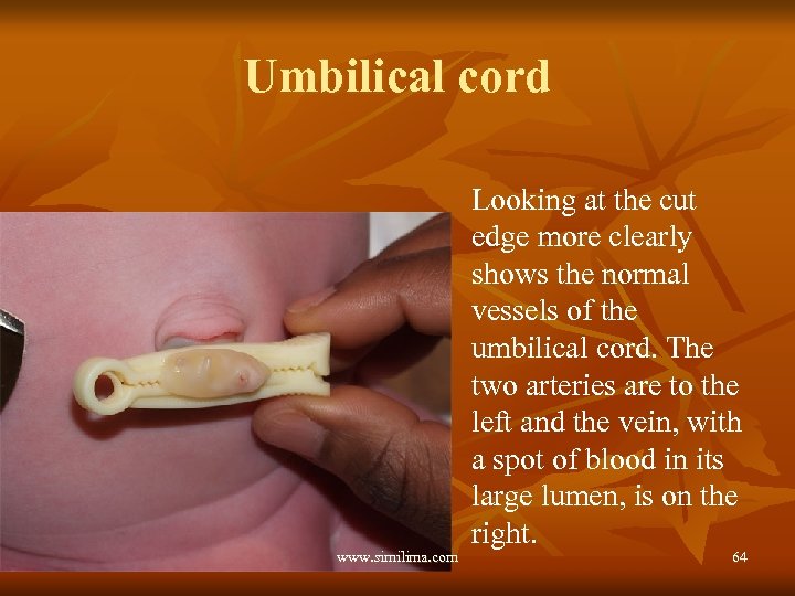 Umbilical cord www. similima. com Looking at the cut edge more clearly shows the