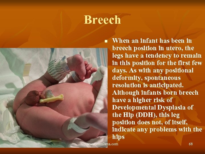 Breech n When an infant has been in breech position in utero, the legs