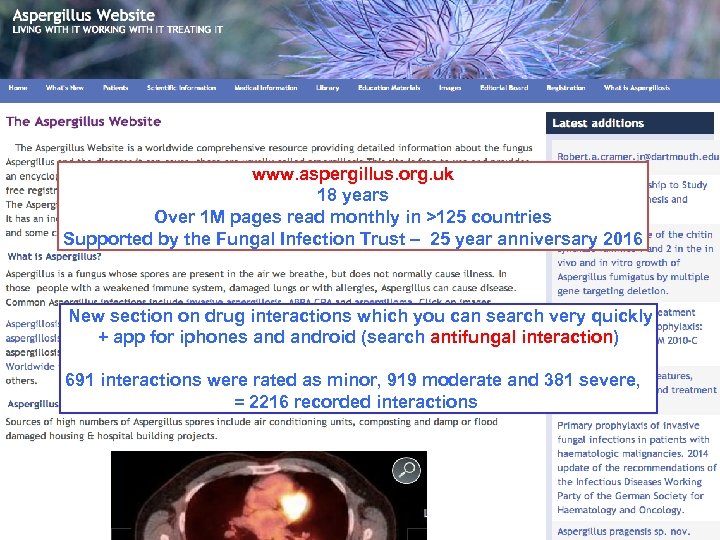 www. aspergillus. org. uk 18 years Over 1 M pages read monthly in >125