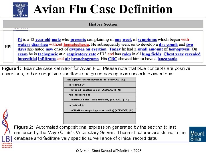 Avian Flu Case Definition Figure 1: Example case definition for Avian Flu. Please note