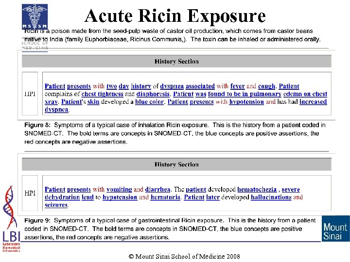 Acute Ricin Exposure © Mount Sinai School of Medicine 2008 