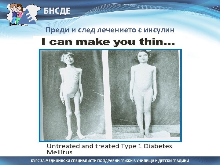 Преди и след лечението с инсулин 