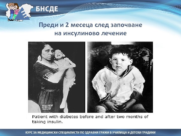 Преди и 2 месеца след започване на инсулиново лечение 