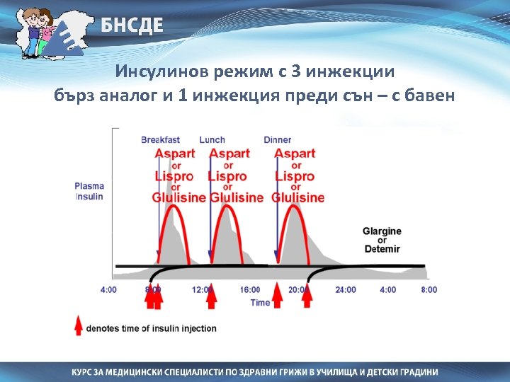 Инсулинов режим с 3 инжекции бърз аналог и 1 инжекция преди сън – с