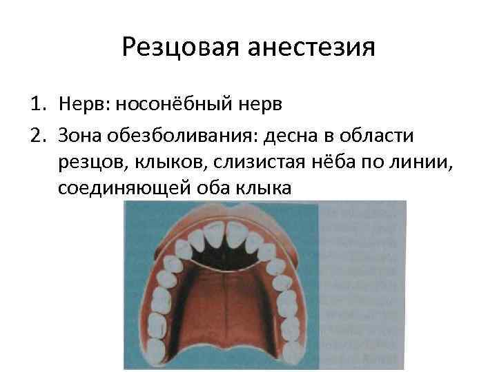 Резцовая анестезия 1. Нерв: носонёбный нерв 2. Зона обезболивания: десна в области резцов, клыков,