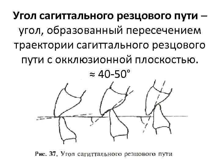 Угол пути. Сагиттальный суставной путь. Сагиттальный суставной и резцовый пути. Угол сагиттального суставного и резцового пути. Сагиттальные движения нижней челюсти.