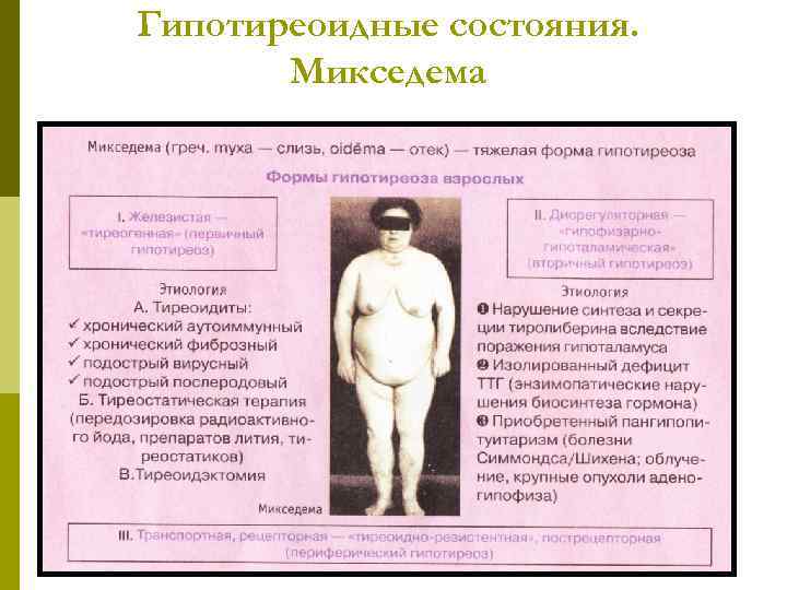 Гипотиреоидные состояния. Микседема 