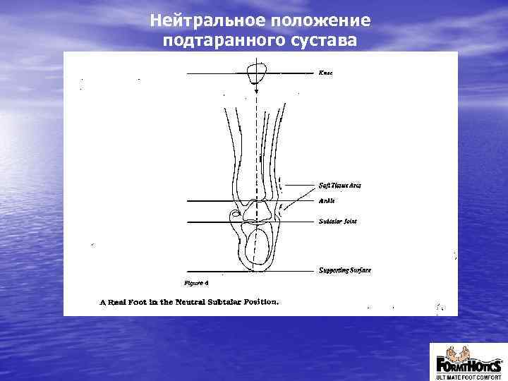 Нейтральное положение подтаранного сустава 