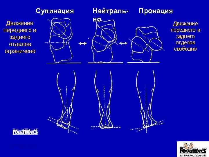 Супинация Движение переднего и заднего отделов ограничено Page 3. 21 Нейтрально Пронация Движение переднего