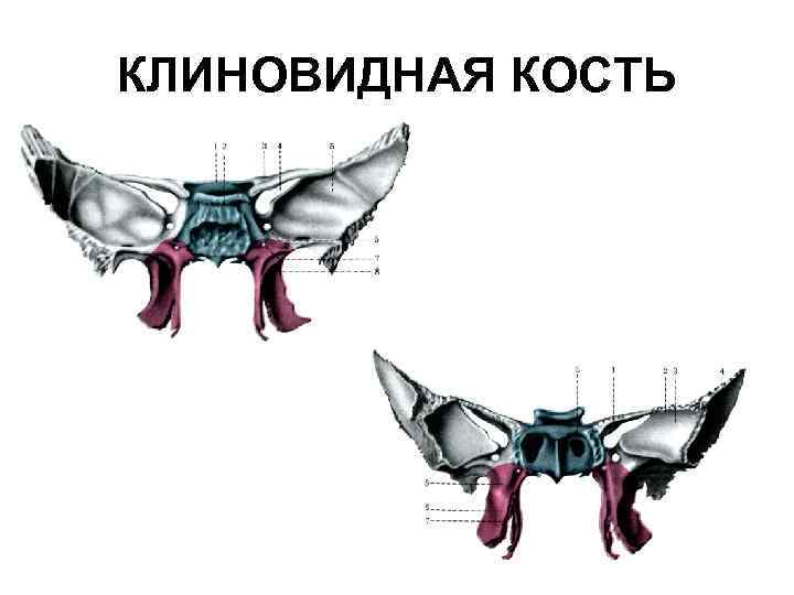 Клиновидная. Клиновидные раковины клиновидной кости. Малое крыло клиновидной кости на кт. Большое крыло клиновидной кости на кт. Крыло клиновидной кости на кт.