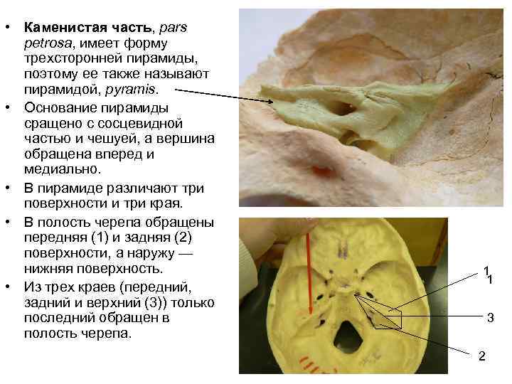  • Каменистая часть, pars petrosa, имеет форму трехсторонней пирамиды, поэтому ее также называют