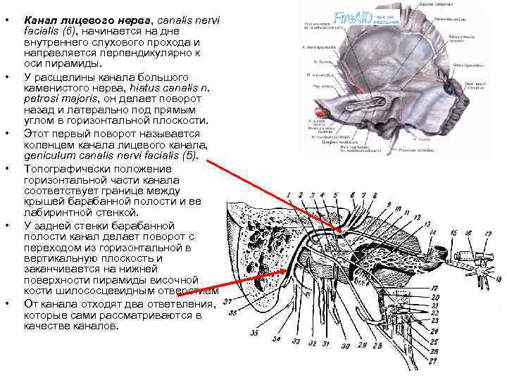 Расщелина канала малого каменистого нерва