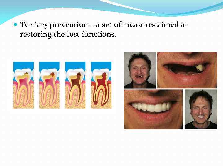  Tertiary prevention – a set of measures aimed at restoring the lost functions.