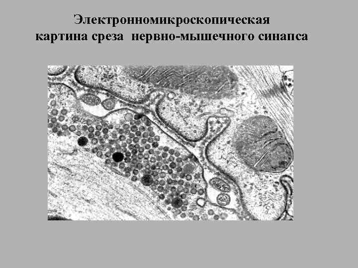 Электронномикроскопическая картина среза нервно-мышечного синапса 