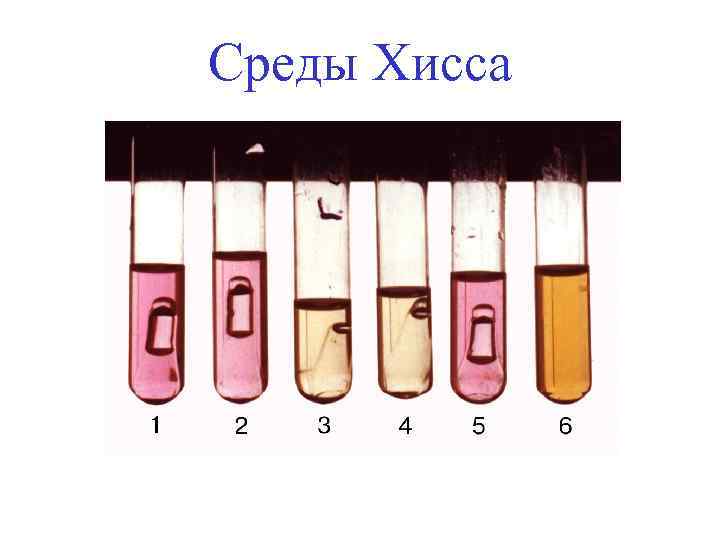 Среды Хисса 