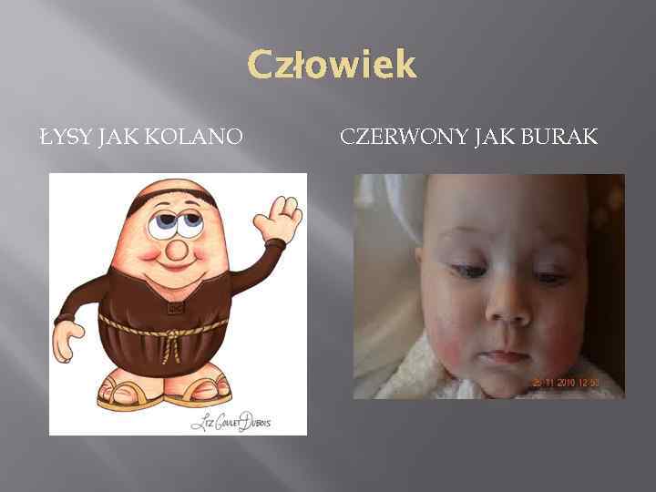 Człowiek ŁYSY JAK KOLANO CZERWONY JAK BURAK 