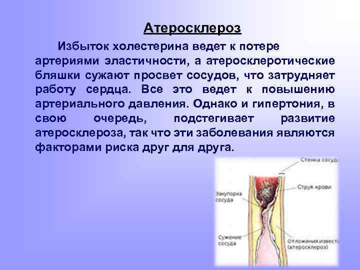 Атеросклероз Избыток холестерина ведет к потере артериями эластичности, а атеросклеротические бляшки сужают просвет сосудов,