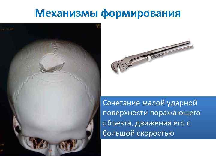 Механизмы формирования Сочетание малой ударной поверхности поражающего объекта, движения его с большой скоростью 