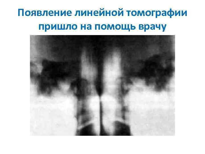 Появление линейной томографии пришло на помощь врачу 