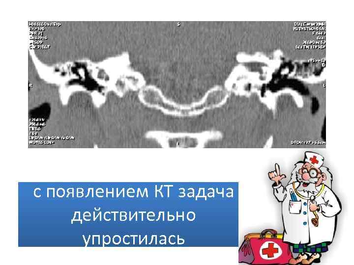 с появлением КТ задача действительно упростилась 
