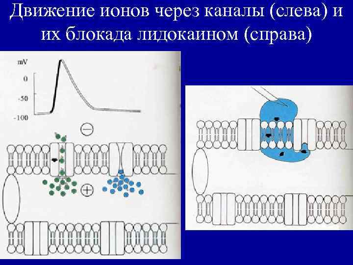 Движение ионов через каналы (слева) и их блокада лидокаином (справа) 