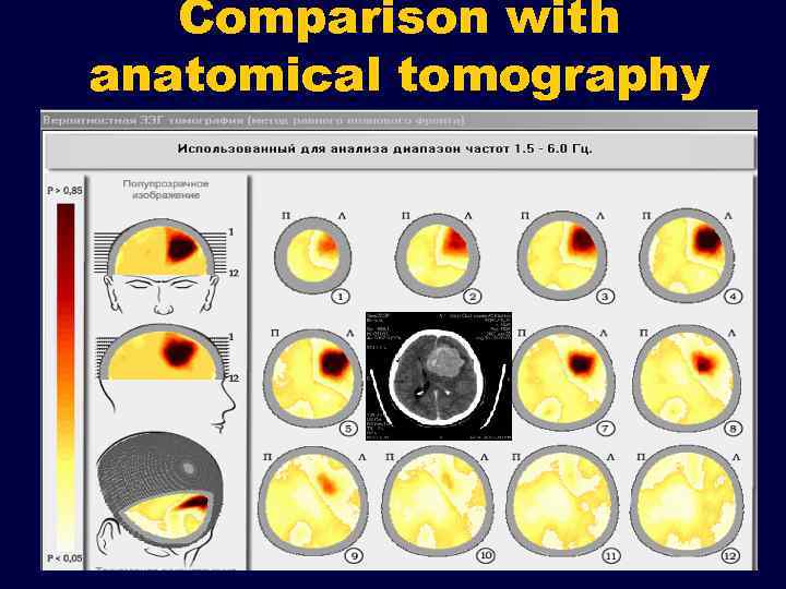 Comparison with anatomical tomography 