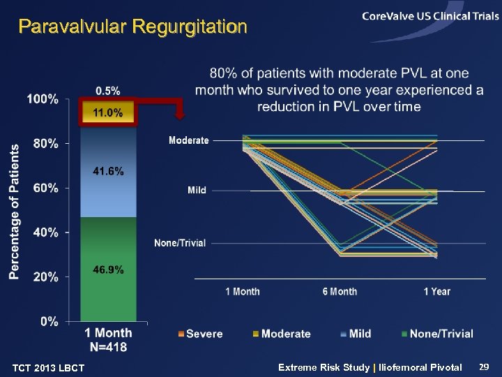 Paravalvular Regurgitation TCT 2013 LBCT Extreme Risk Study | Iliofemoral Pivotal 29 