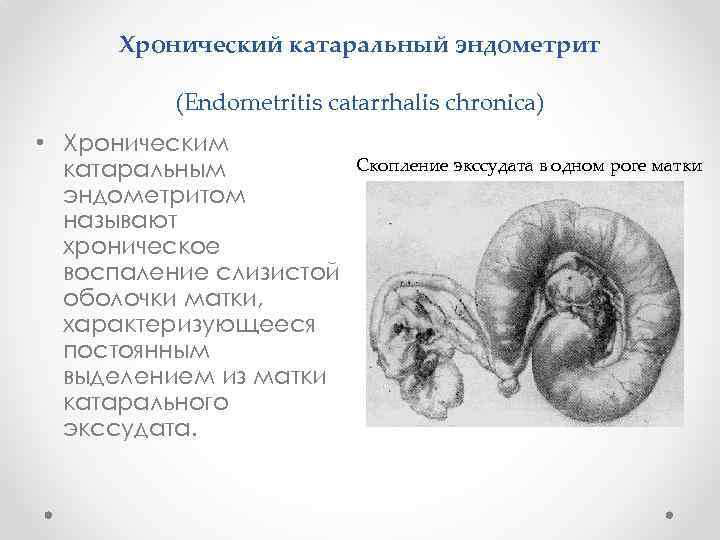 Хронический катаральный эндометрит (Endometritis catarrhalis chronica) • Хроническим катаральным эндометритом называют хроническое воспаление слизистой