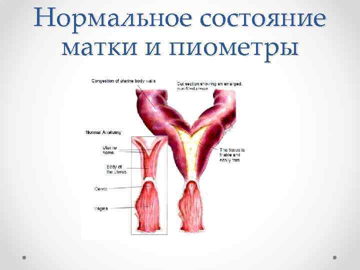 Нормальное состояние матки и пиометры 