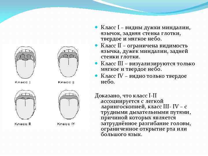 Небо мягкое и твердое схема