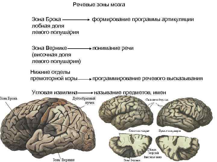 Речевое полушарие мозга