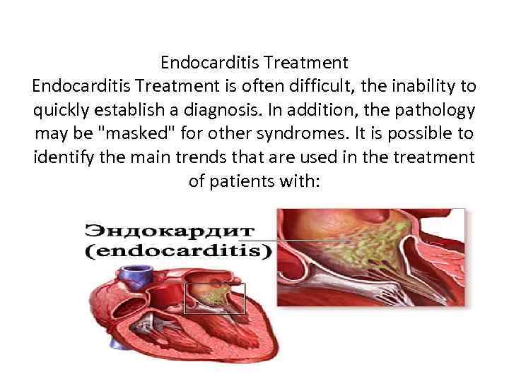 Endocarditis Treatment is often difficult, the inability to quickly establish a diagnosis. In addition,