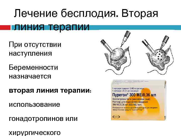 Лечение бесплодия. Вторая линия терапии При отсутствии наступления Беременности назначается вторая линия терапии: использование