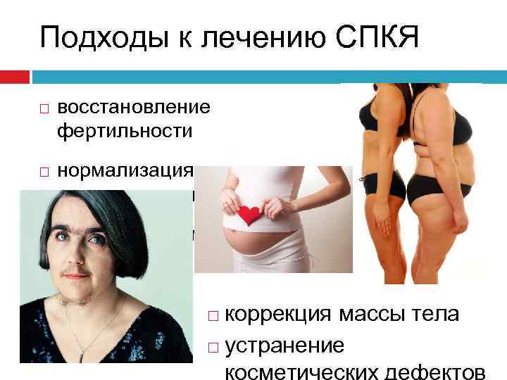 Подходы к лечению СПКЯ восстановление фертильности нормализация менструального цикла минимизация метаболических нарушений коррекция массы