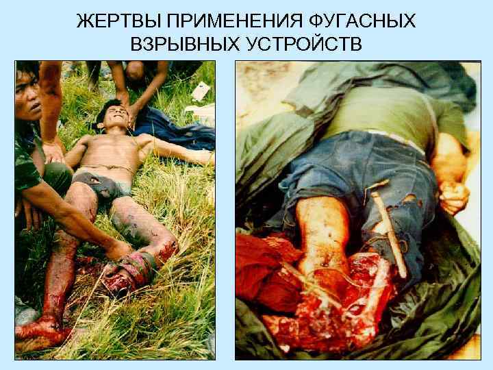 ЖЕРТВЫ ПРИМЕНЕНИЯ ФУГАСНЫХ ВЗРЫВНЫХ УСТРОЙСТВ 