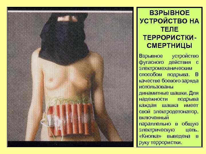 ВЗРЫВНОЕ УСТРОЙСТВО НА ТЕЛЕ ТЕРРОРИСТКИСМЕРТНИЦЫ Взрывное устройство фугасного действия с электромеханическим способом подрыва. В