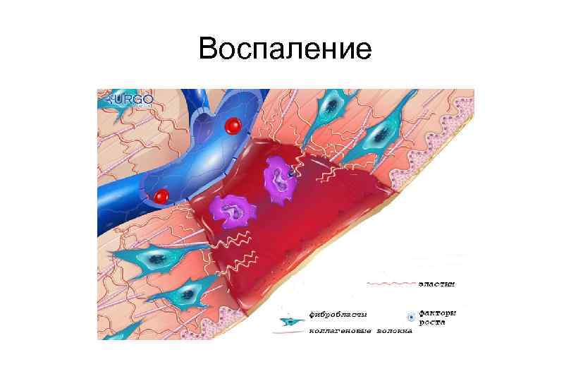 Воспаление 