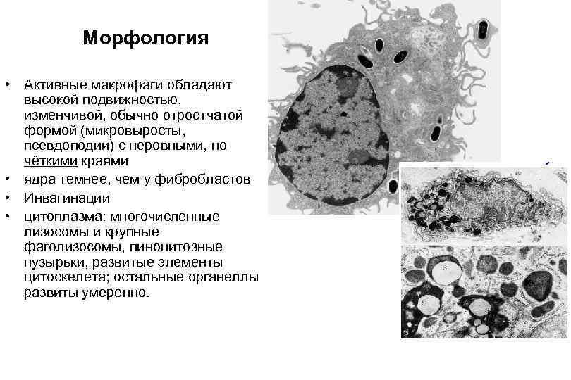 Морфология • Активные макрофаги обладают высокой подвижностью, изменчивой, обычно отростчатой формой (микровыросты, псевдоподии) с