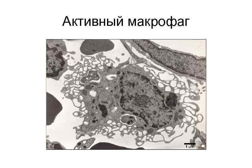Активный макрофаг 