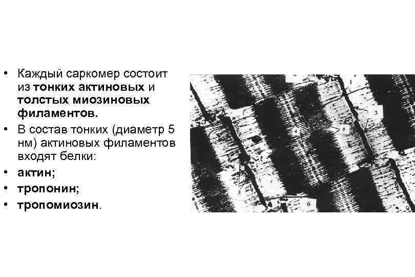  • Каждый саркомер состоит из тонких актиновых и толстых миозиновых филаментов. • В