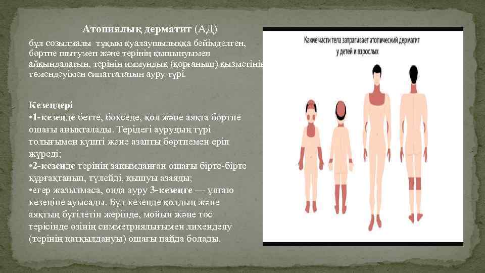 Атопиялық дерматит (АД) бұл созылмалы тұқым қуалаушылыққа бейімделген, бөртпе шығумен және терінің қышынуымен айқындалатын,
