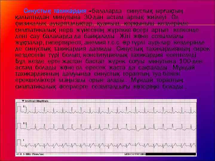 Синустық тахикардия –балаларда синустық ырғақтың қалыптыдан минутына 30 -дан астам артық жиілеуі. Ол физикалық